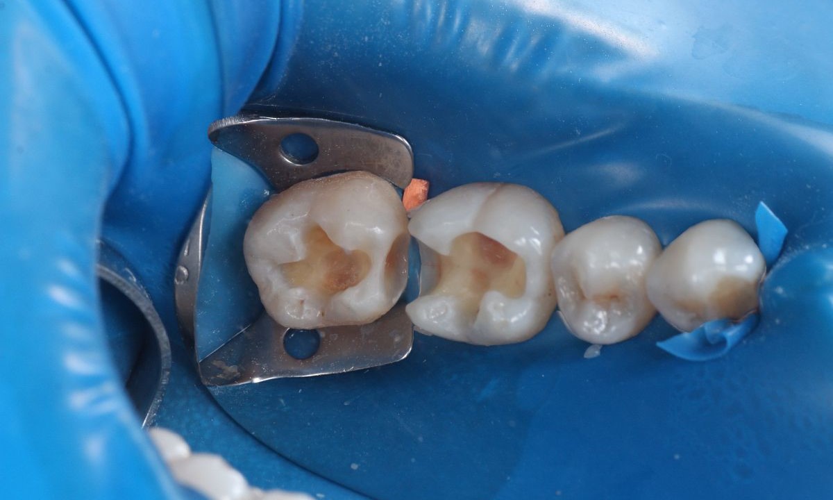 До (Терапія)