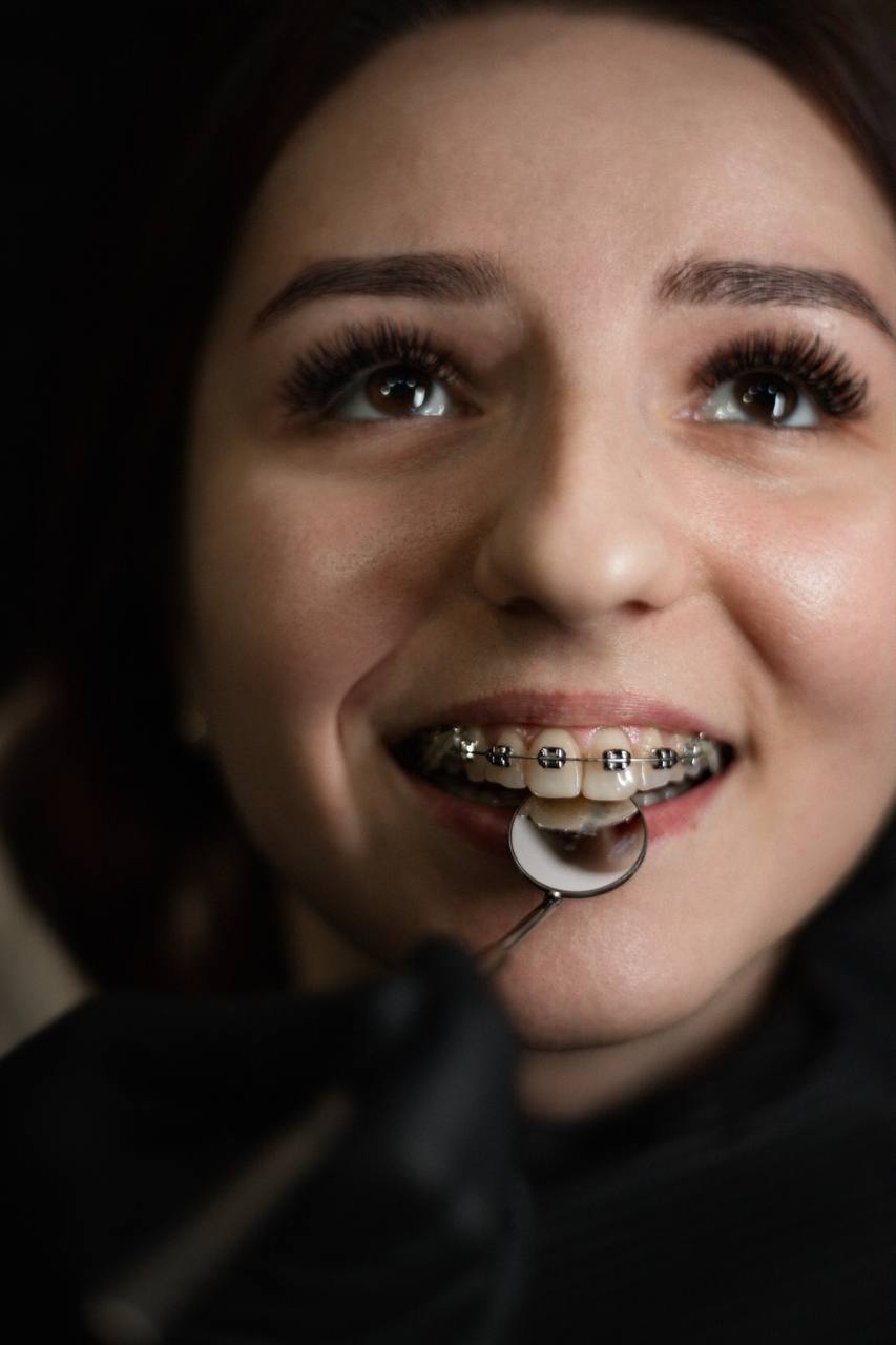 Ортодонтія GeneralDental