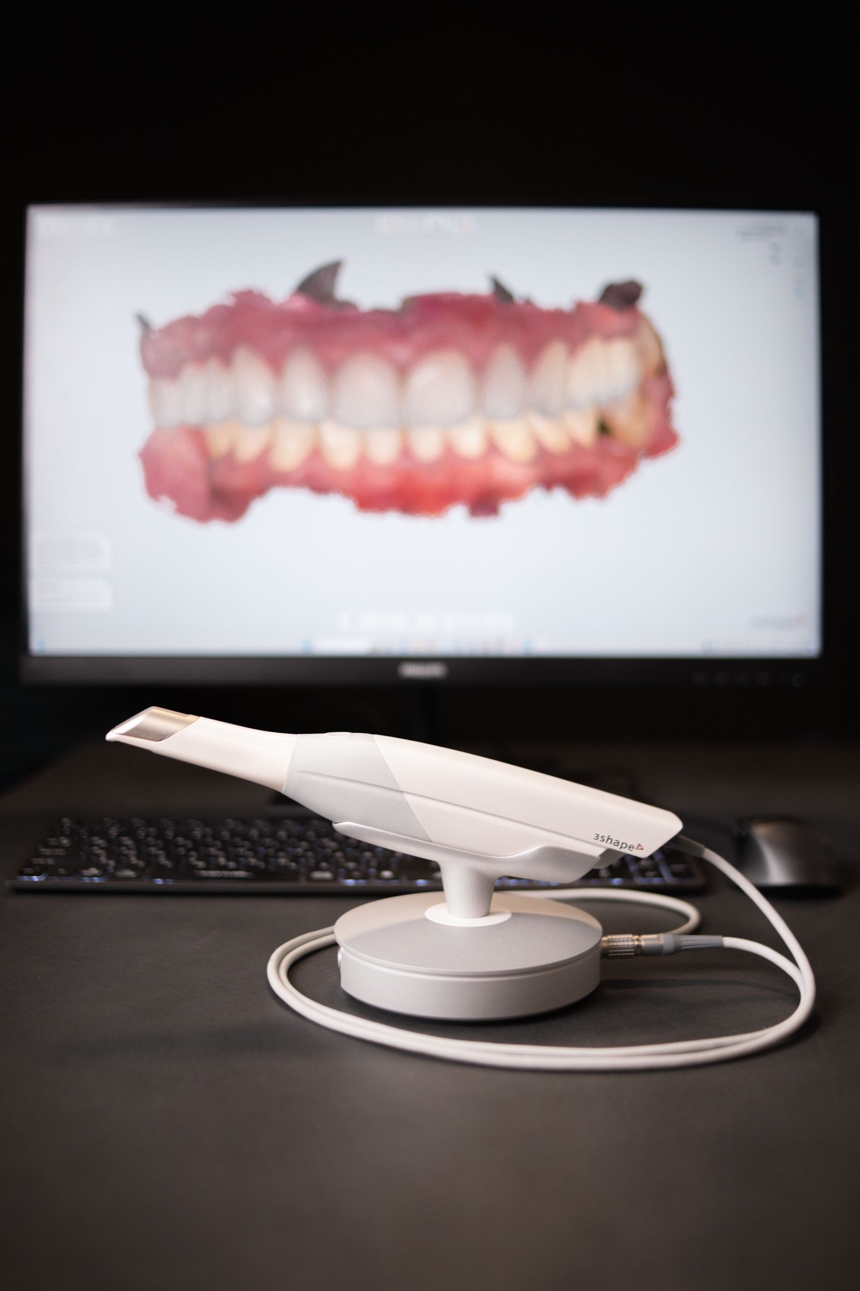 GeneralDental Цифрове сканування